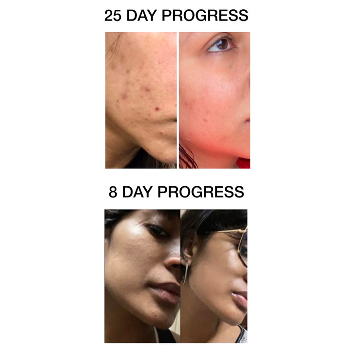 CLARIFYING AND BRIGHTENING SERUM