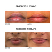 Lip Repair Oil